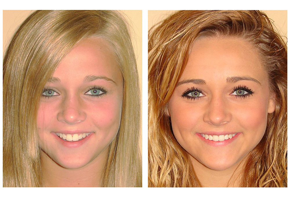 Burns Family Dentistry